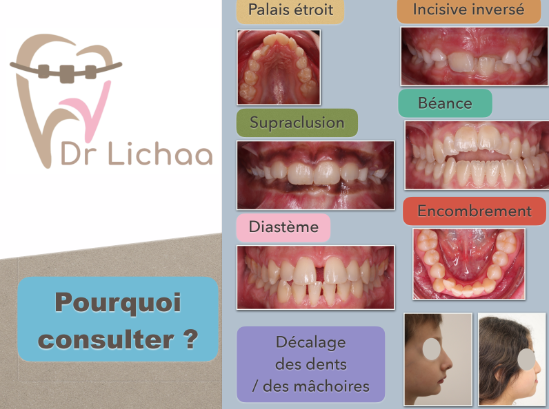 traitement orthodontique